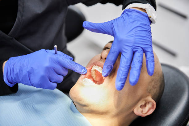 Best Emergency Root Canal Treatment in Middletown, VA